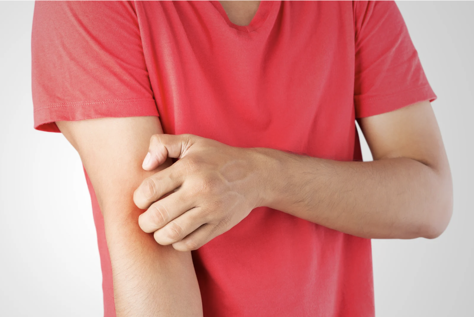 dermatology-surgery-associates-dsa-bronx-ny-intertrigo
