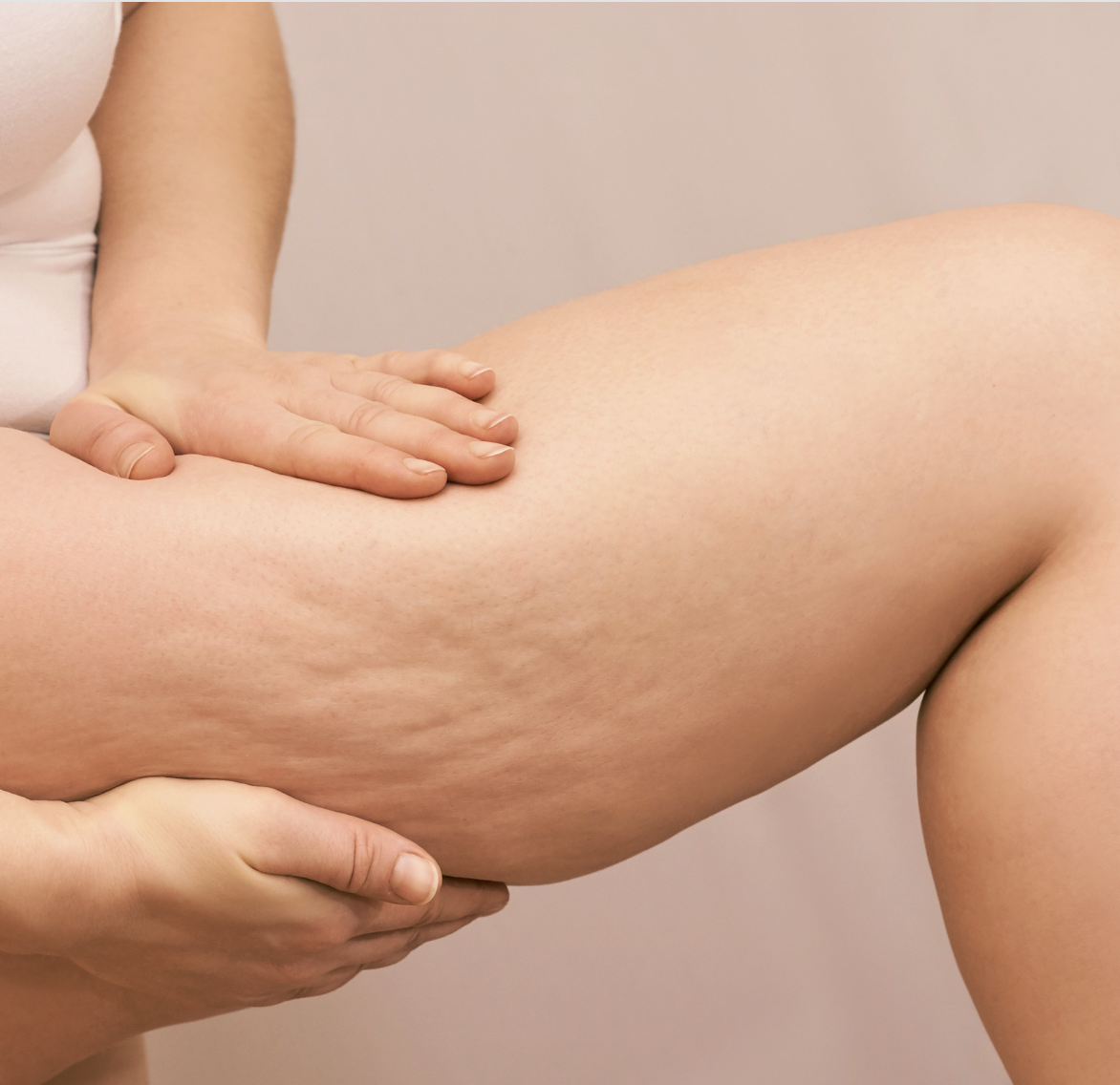 dermatology-surgery-associates-dsa-bronx-ny-liposuction-1