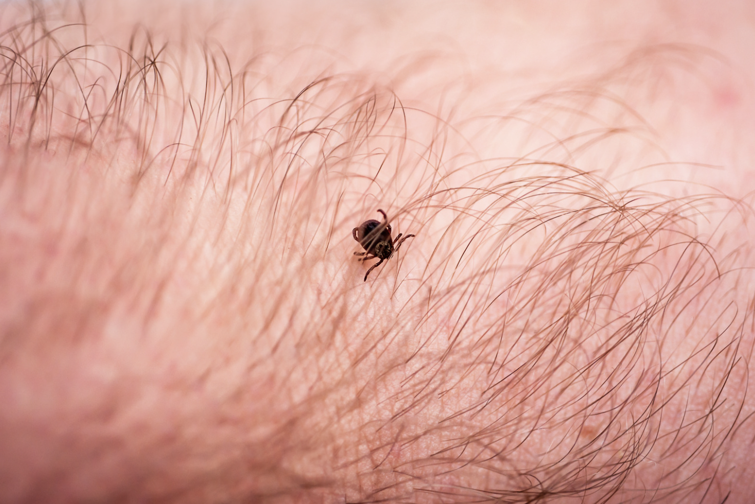 dermatology-surgery-associates-dsa-bronx-ny-lyme-disease