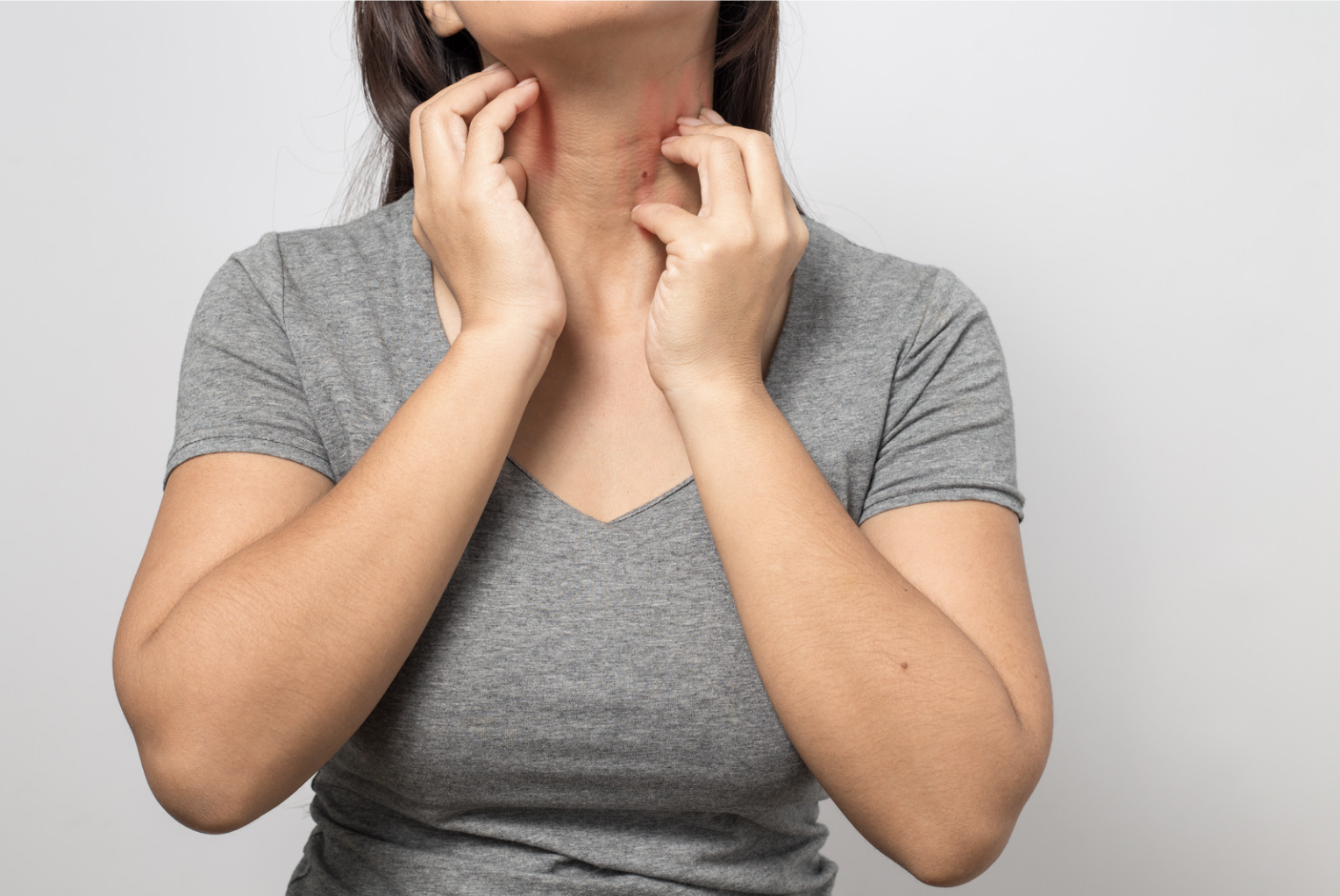 dermatology-surgery-associates-dsa-bronx-ny-pruritis-1