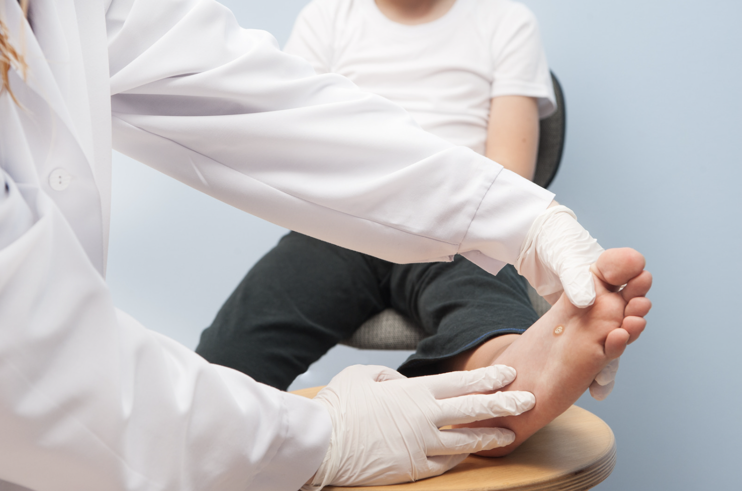 dermatology-surgery-associates-dsa-bronxy-ny-warts-1
