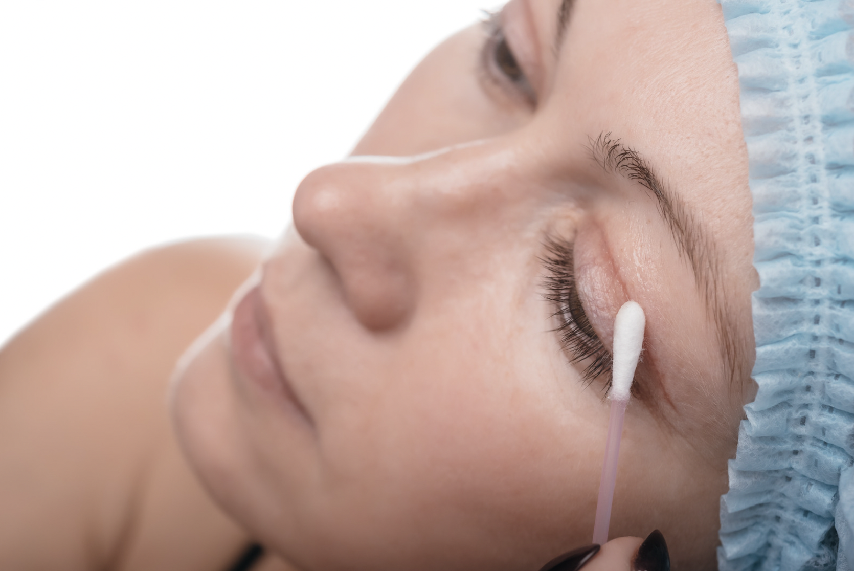 dermatology-surgery-associates-dsa-bronx-eyelid-surgery