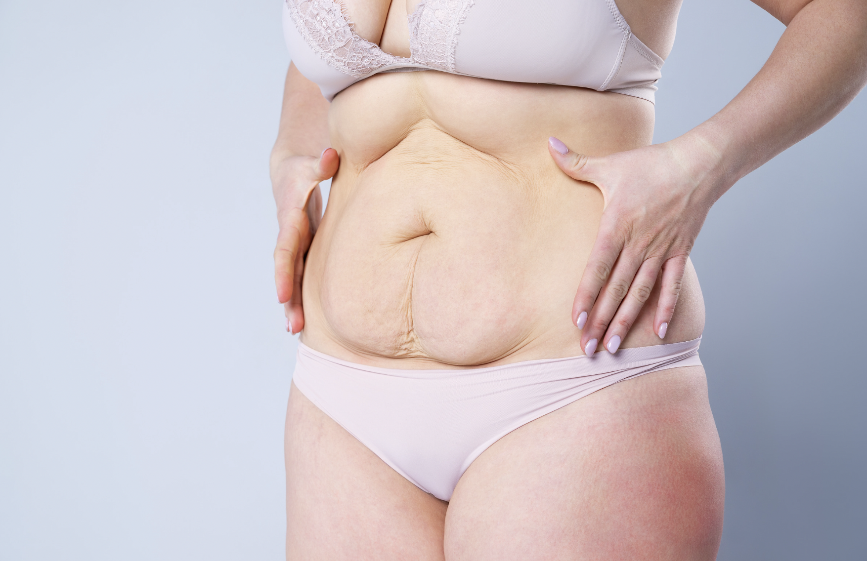 dermatology-surgery-associates-dsa-bronx-ny-body-procedures dermatology surgery associates body contouring bronx ny