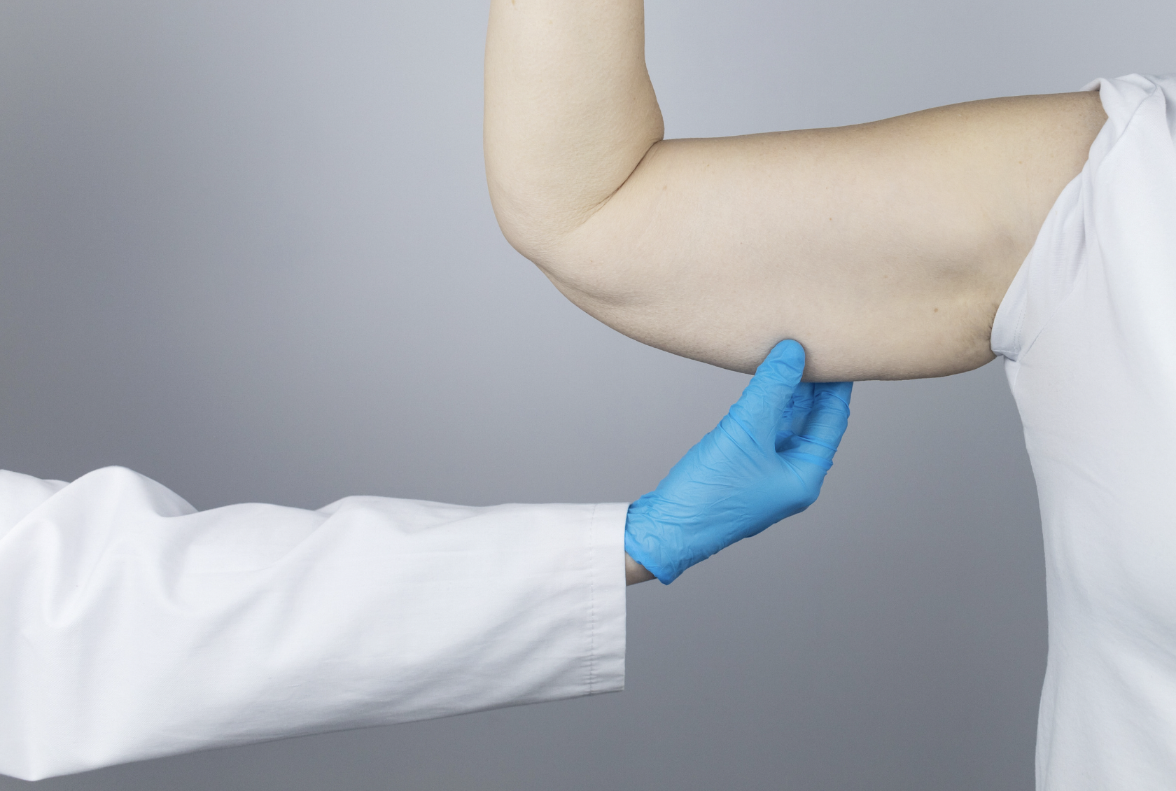dermatology-surgery-associates-dsa-bronx-ny-brachioplasty-arm-lift