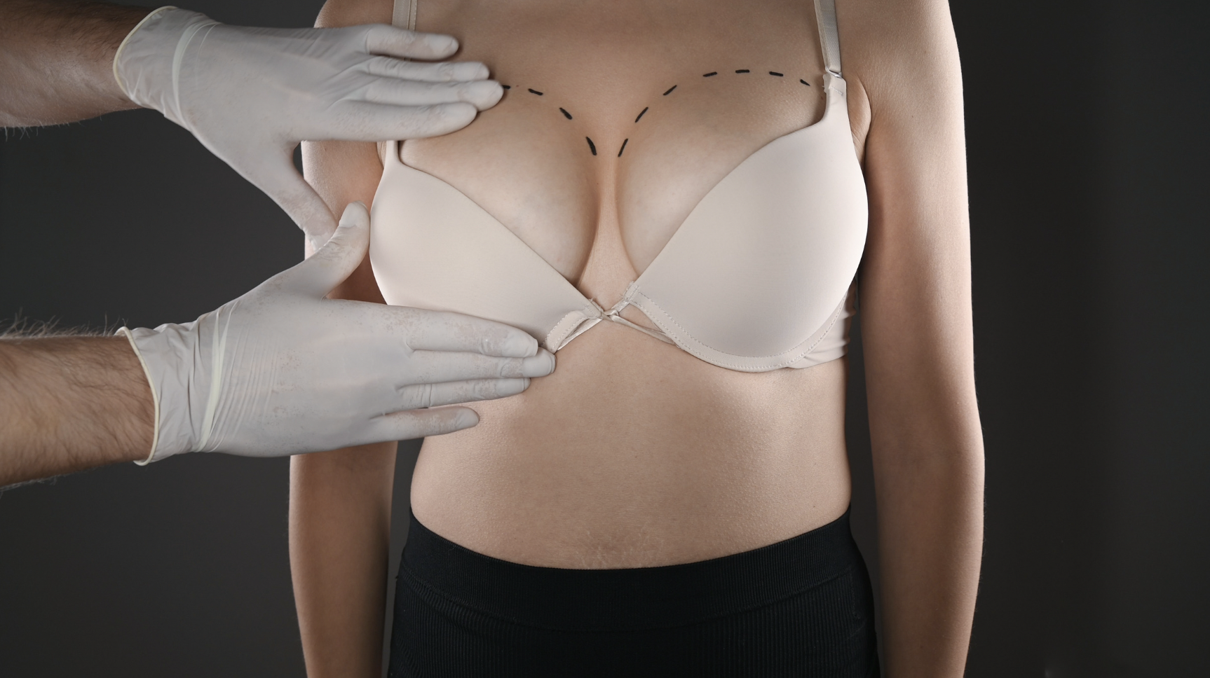 dermatology-surgery-associates-dsa-bronx-ny-breast--surgery