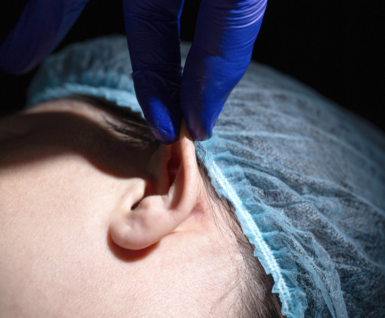 dermatology-surgery-associates-dsa-bronx-ny-ear-surgery-otoplasty-1