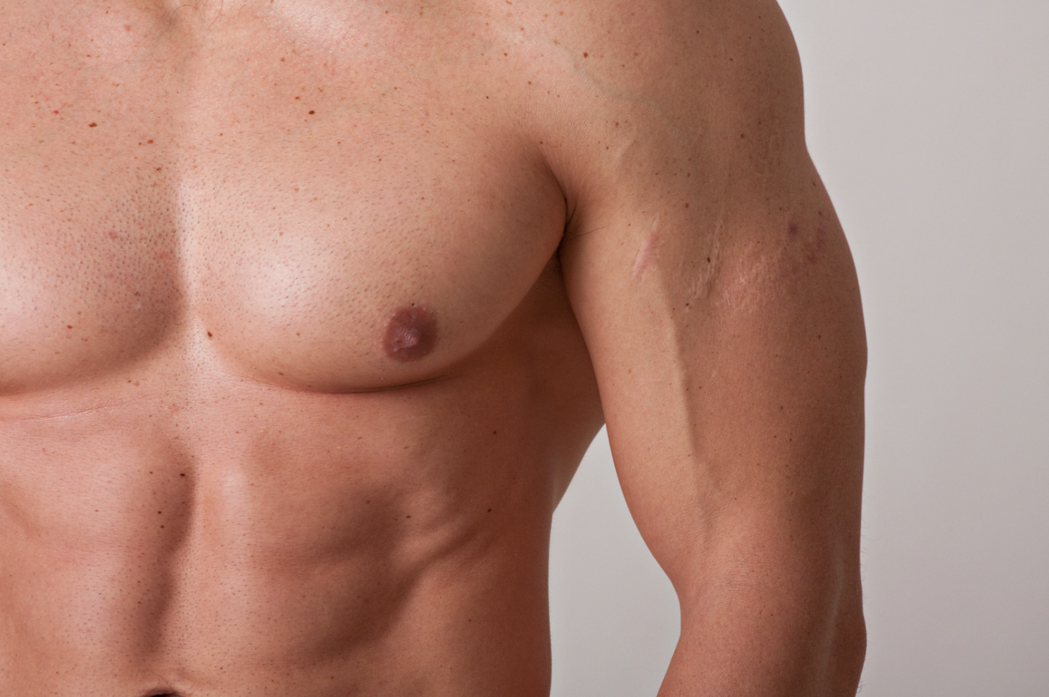dermatology-surgery-associates-dsa-bronx-ny-male-breast-reduction-1