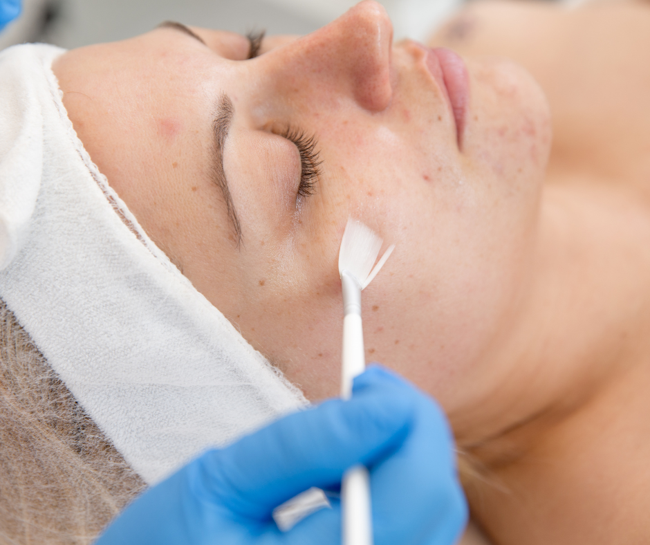 types-of-chemical-peels-which-is-right-for-you-dermatology-and-surgery-associates-bronx-plastic-surgery-new-york-2